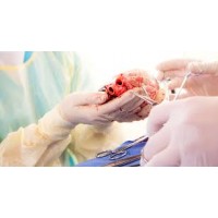 Physician Mailing List By Specialty - Transplant Surgeons
